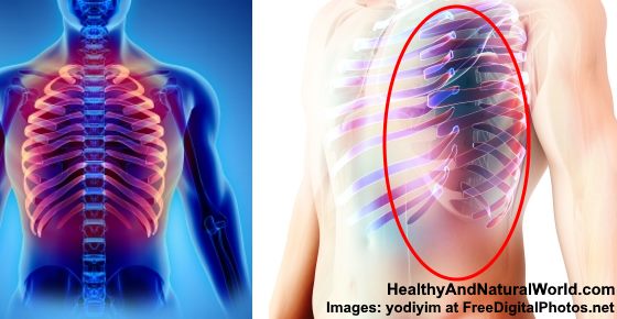 Pain in Left Side Under Ribs