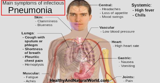 Is Pneumonia Contagious, Causes, Symptoms and Transmission