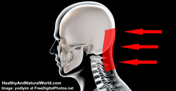 Pain in Base of Skull: What Headache at Base of Skull Means