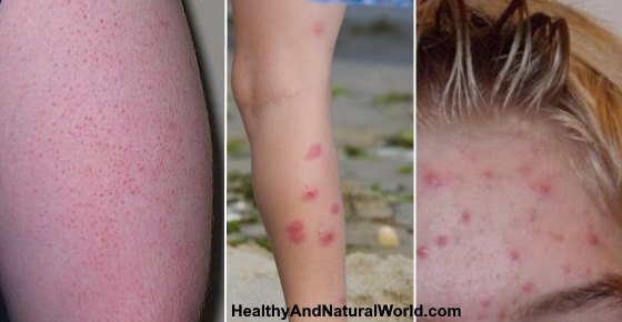 Red Spots On Skin: Causes, Treatments and More