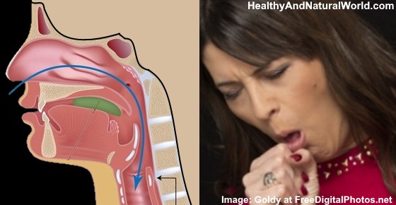 Coughing Up Brown or Black Mucus: What It Means