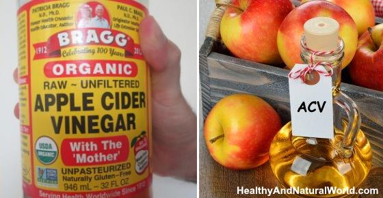 Apple Cider Vinegar with the Mother: Uses, Amazing Benefits, and More