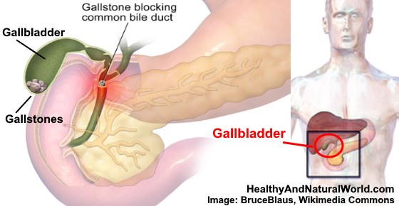 How to Get Rid of Gallstones (Including Gallbladder Cleanse & Flush)