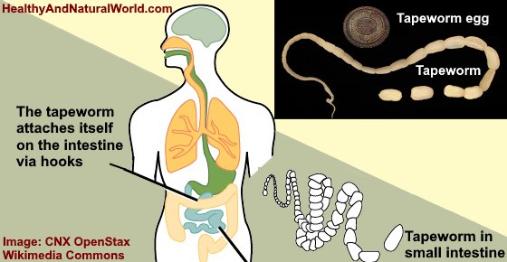 Tapeworms In Humans Symptoms And Treatments Pictures Included