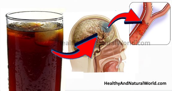 diet soda causes barain damage