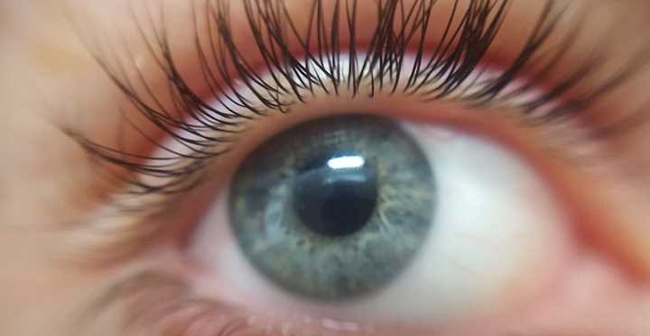 Eyelash mites